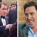 Rob Brydon Hair Transplant: Everything You Need To Know