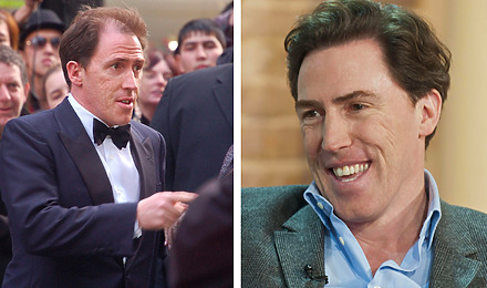 Rob Brydon Before And After Hair Restoration