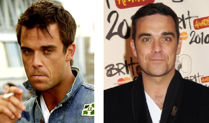 Robbie Williams in 2000 (left) and 2010 (right)