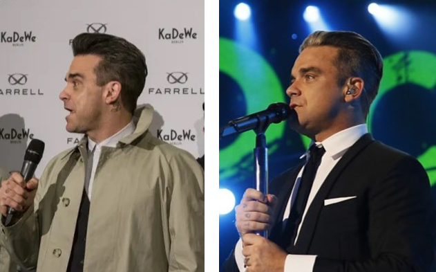 Robbie Williams’s hair in February 2013 vs November 2013