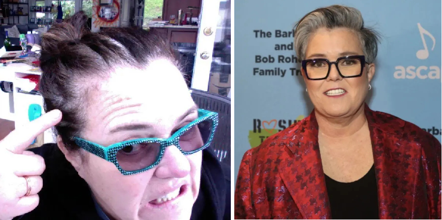 Rosie O'Donnell hair loss