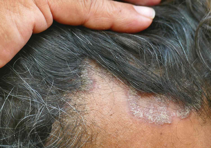 23 Causes Of An Itchy Scalp, According To The NHS