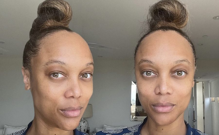 Tyra Banks' makeup free photo showing her hair loss