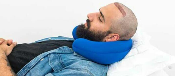 man sleeping with neck pillow after hair transplant