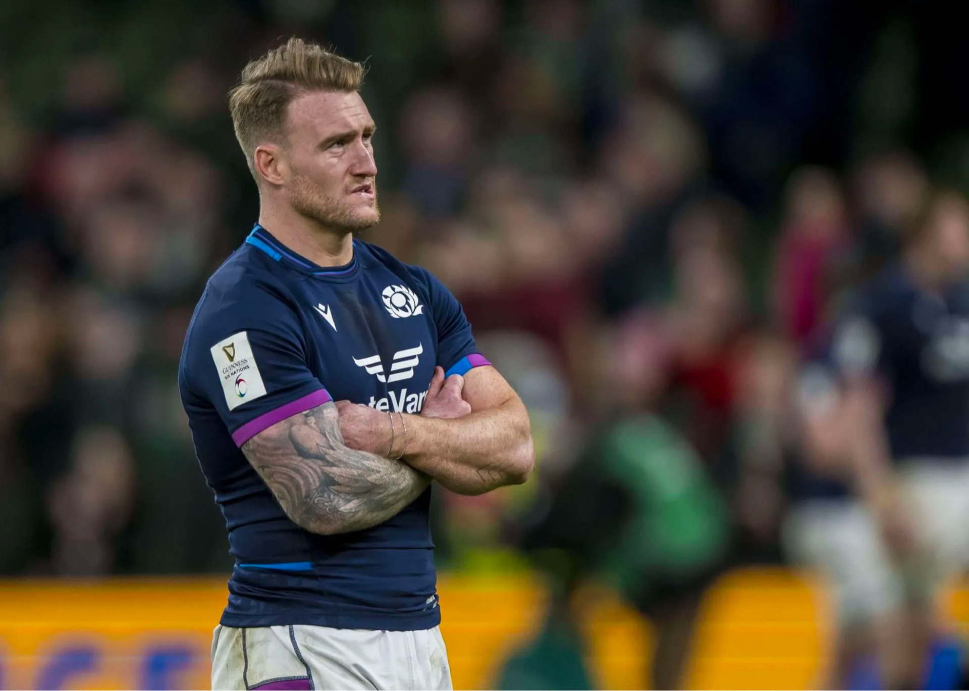 Stuart Hogg’s Hair Transplant: Everything You Need To Know, Wimpole Clinic