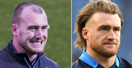 Stuart Hogg’s Hair Transplant: Everything You Need To Know