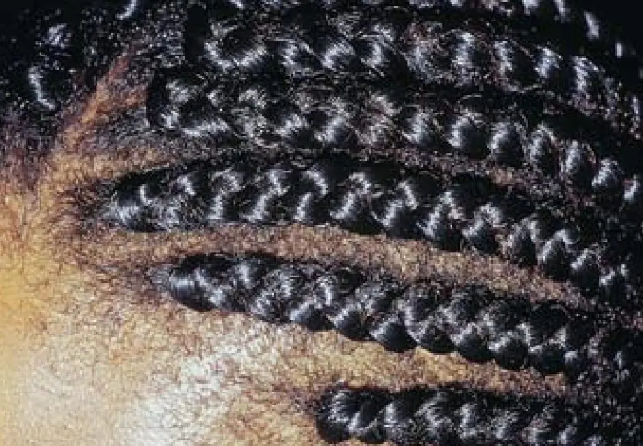 The early stage of traction alopecia