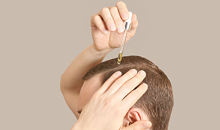 Topical Finasteride Featured Image