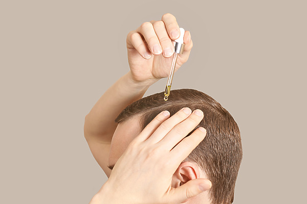 Topical Finasteride Featured Image