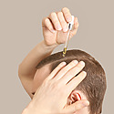 Topical Finasteride Guide: Uses, Results & Safety
