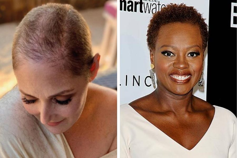 17 Female Celebrities With Thin Hair Who Proved It's All About Style