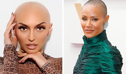 Celebrities With Alopecia Featured Image