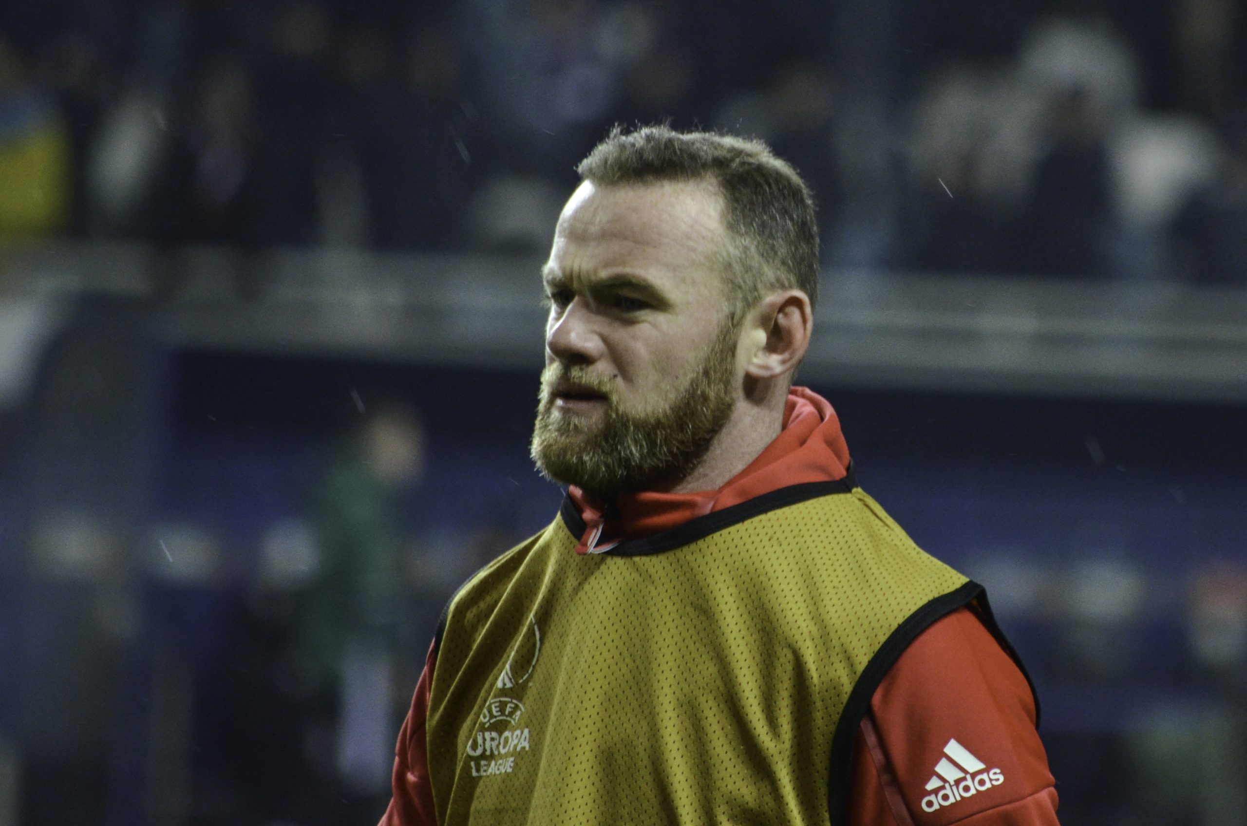 wayne rooney hair transplant