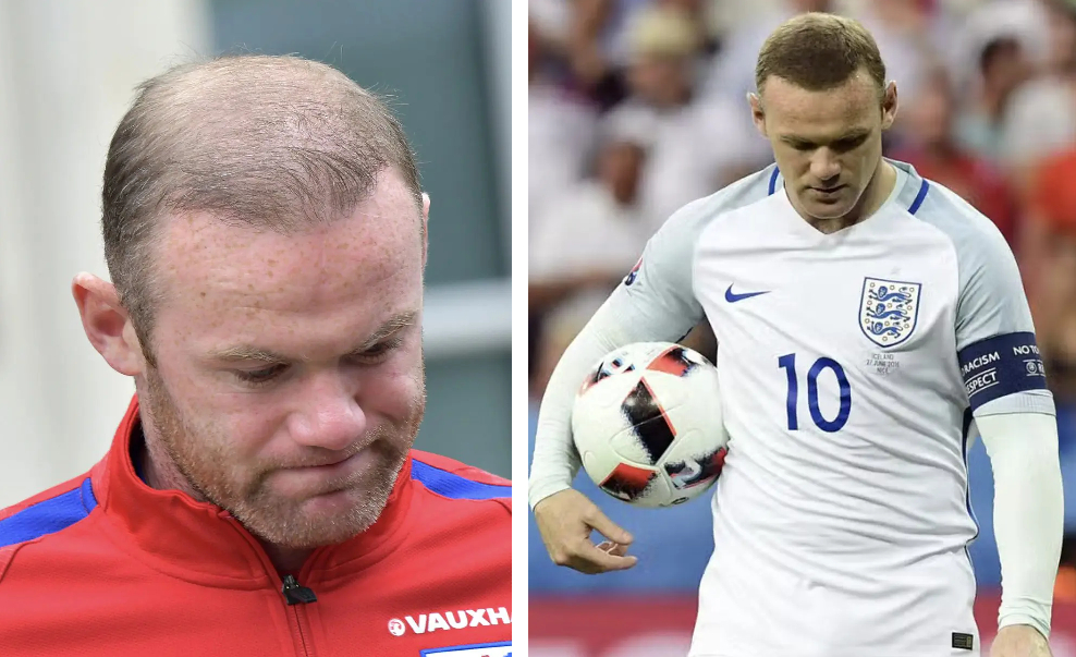 Wayne Rooney's hair throughout the years