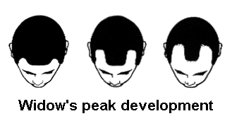 A guide as to how the widow's peak develops