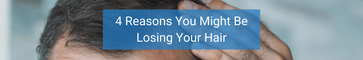 4 Reasons You Might Be Losing Your Hair