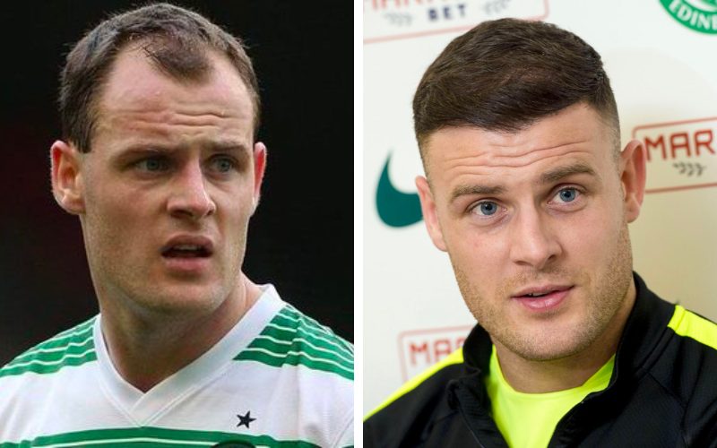 Anthony Stokes's hairline before and after