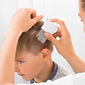 Childhood Hair Loss: What Are The Causes?