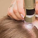 Common Diagnostic Trichology Tests Your Hair Specialist Will Perform