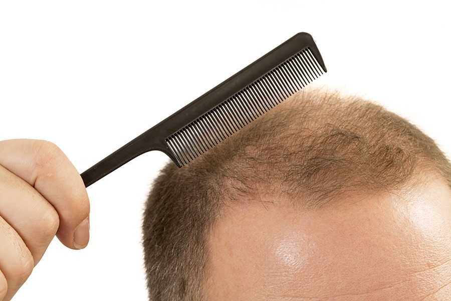 Common Scalp Problems And How To Treat Them