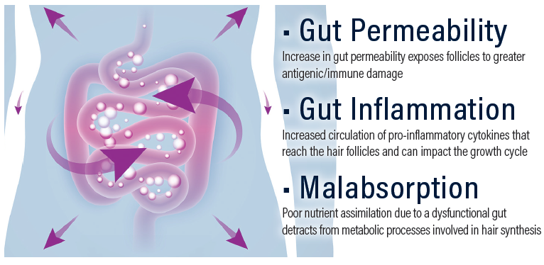 Healthy gut microbiome informational graphic
