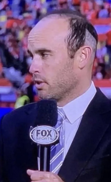 landon donovan. image credit fox sports