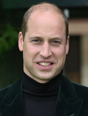 prince william hair loss norwood stage 6