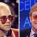 Elton John Hair Transplant: Everything You Need To Know