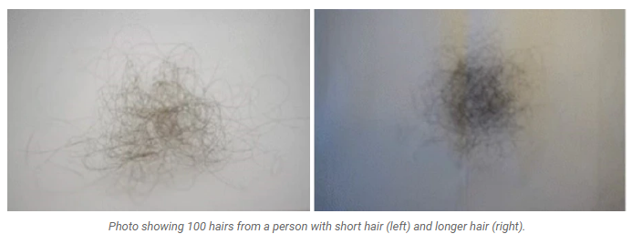 example of normal daily hair shedding