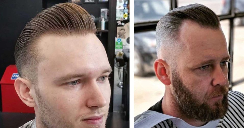 Is it okay to shape up the hairline as a guy with a trimmer to look good? -  Quora