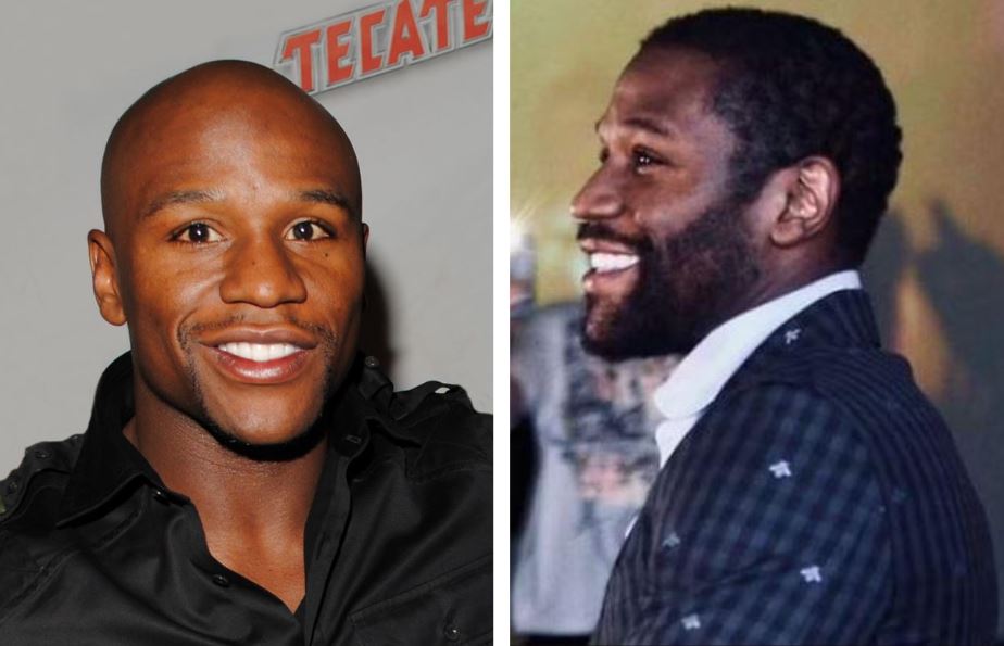 Floyd Mayweather before and after rumoured hair transplant