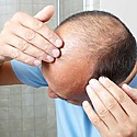 FUE Hair Transplants – How Long Will It Take To See Results?