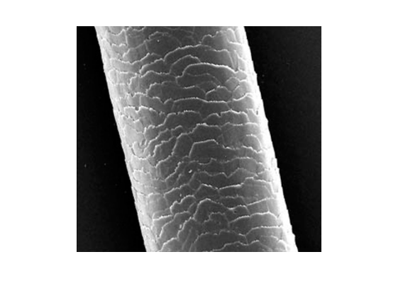 microscopic photo of a damaged hair follicle
