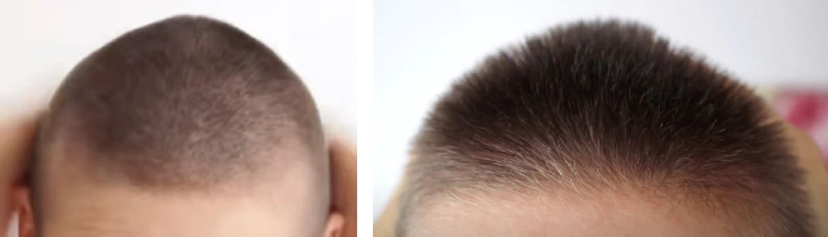 natural hair regrowth in 1 month