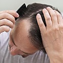 Hair Thinning On One Side: Common Causes & Treatments