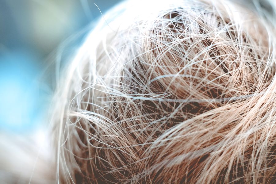 Improving hair texture damaged by iron deficiency - Blog - Wimpole