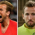 Harry Kane Hair Transplant: Everything You Need To Know