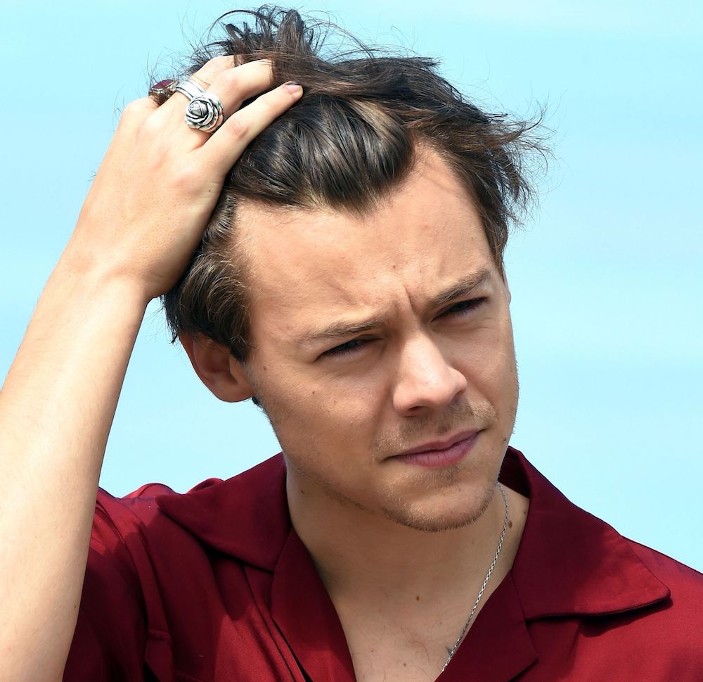 harry styles m-shaped hairline