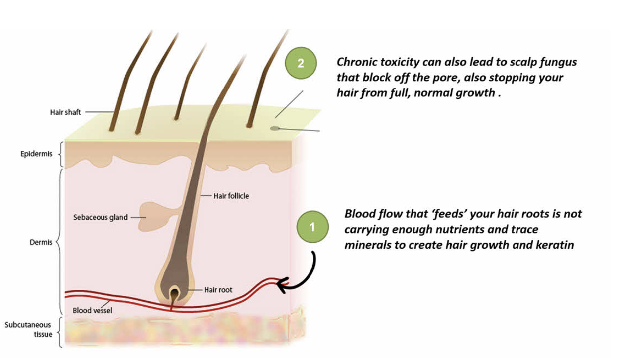 Informational graphic showing how MS inhibits hair growth in hair follicles