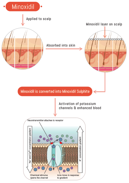 informational graphic showing how Minoxidil works to stimulate hair growth