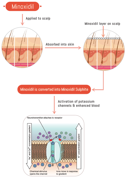 informational graphic showing how Minoxidil works to stimulate hair follicles