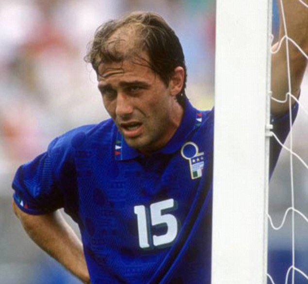 Antonio Conte in 1994 with severe hair loss