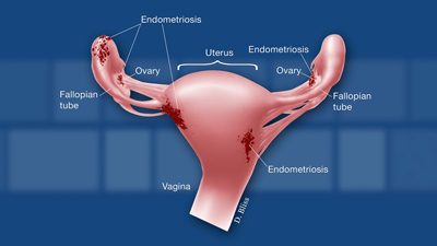 information graphic showing the female reproductive system