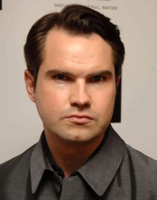 jimmy carr before hair transplant