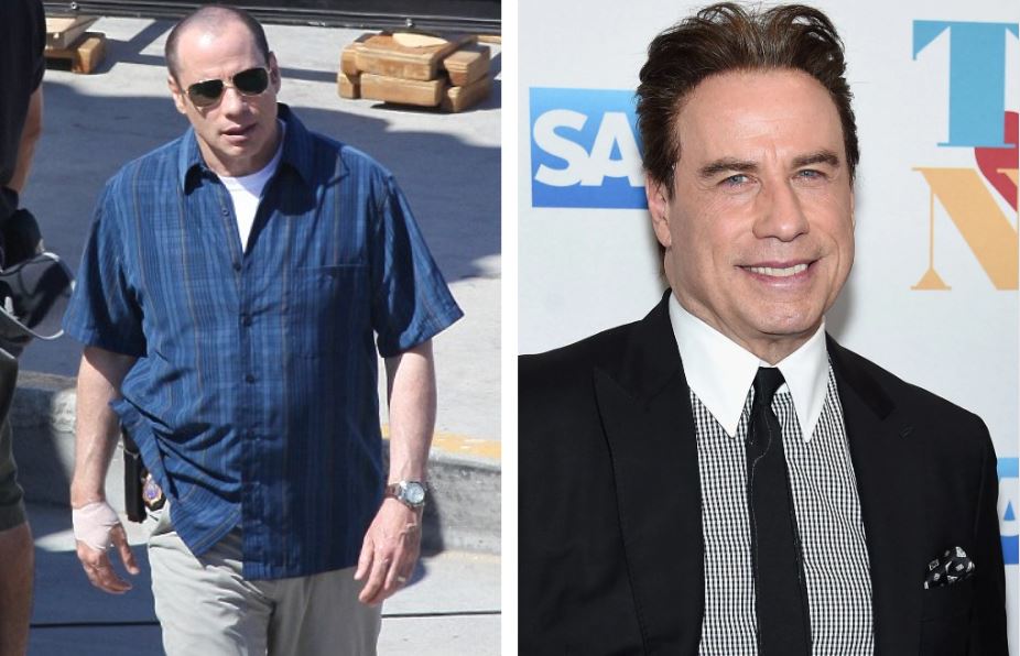 John Travolta before and after rumoured hair transplant