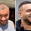 Jonathan Joseph Hair Transplant: Everything You Need To Know