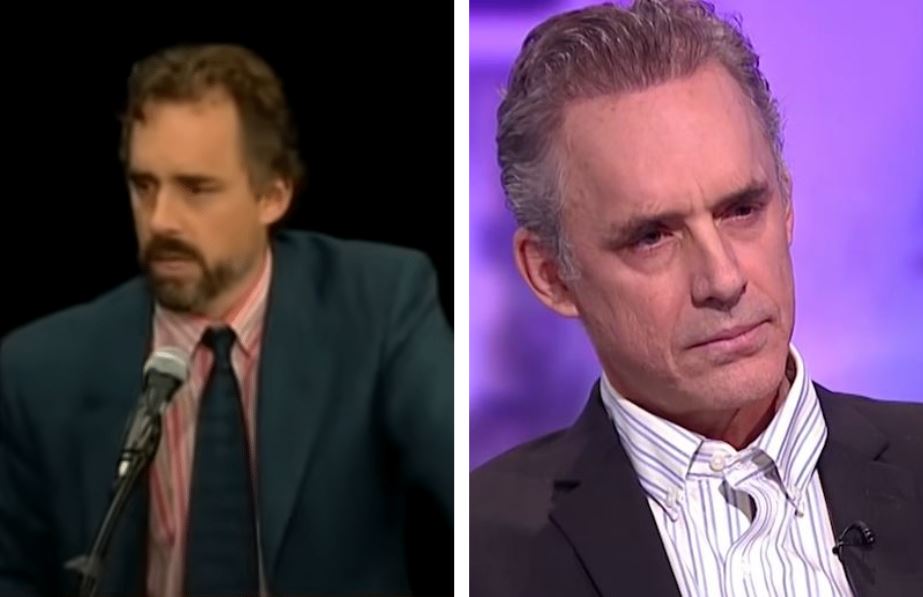 Jordan Peterson before and after rumoured hair transplant