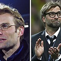 Jurgen Klopp Hair Transplant: Everything You Need To Know