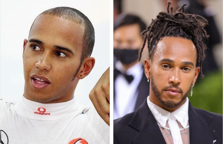 Lewis Hamilton before and after rumoured hair transplant