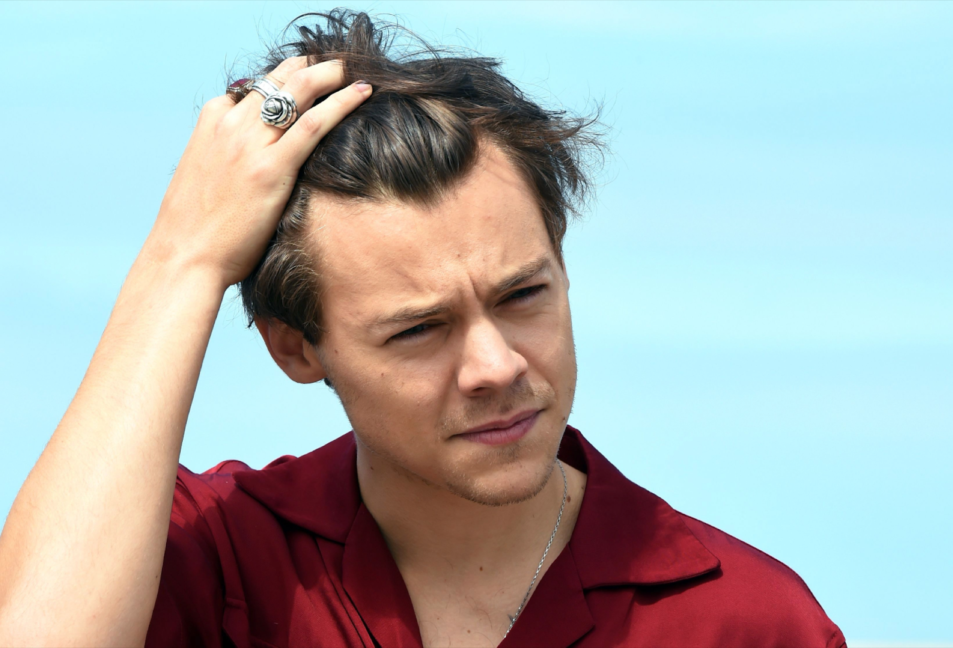 Harry Styles' m-shaped hairline